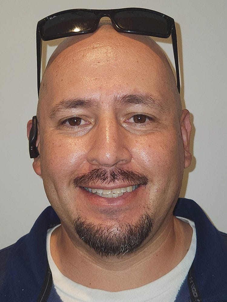 cosmetic smile gallery