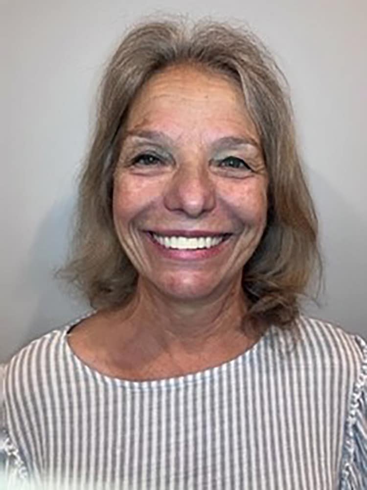 cosmetic smile gallery