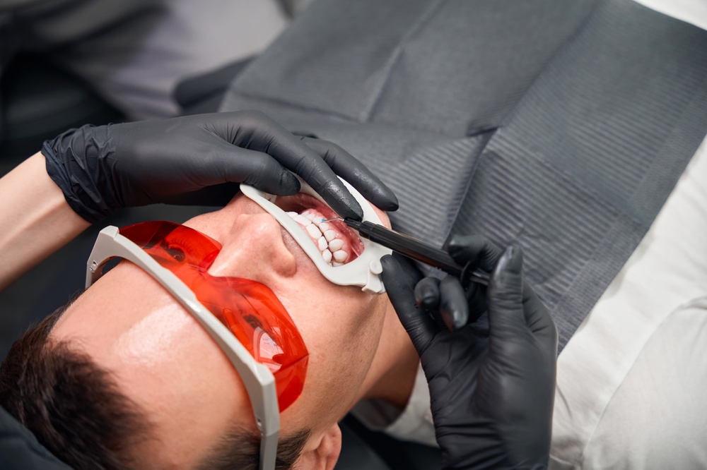 teeth whitening mesa